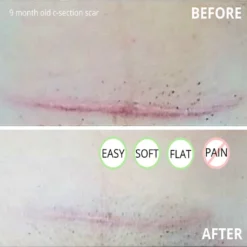 Award-winning CicaLux Energised Scar Care For Old And New Scars -Kids Toy Shop Award winning CicaLux Energised Scar Care for Old and New Scars Bebelephant 1603205188