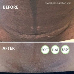 Award-winning CicaLux Energised Scar Care For Old And New Scars -Kids Toy Shop Award winning CicaLux Energized Scar Care for Old and New Scars Bebelephant 1603199402