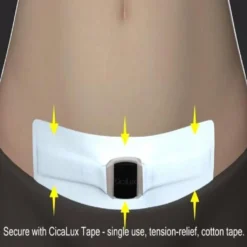 Award-winning CicaLux Energised Scar Care For Old And New Scars -Kids Toy Shop CicaLux Energised Scar Care Bebelephant 1599260608